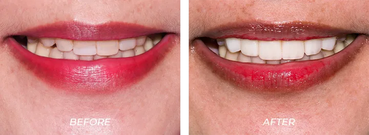 Short Teeth 01