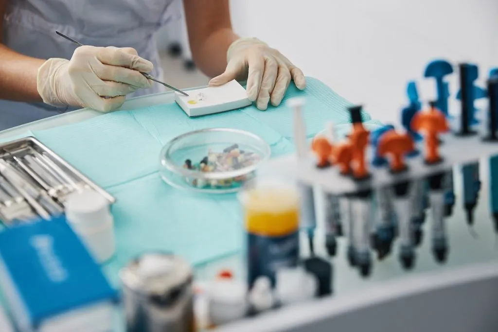 5 Benefits of Dental Fillings