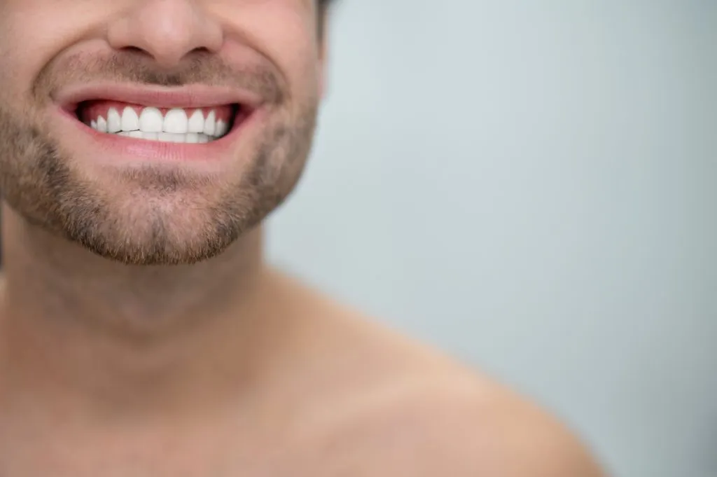 4 Benefits Of Having Zirconia Veneers