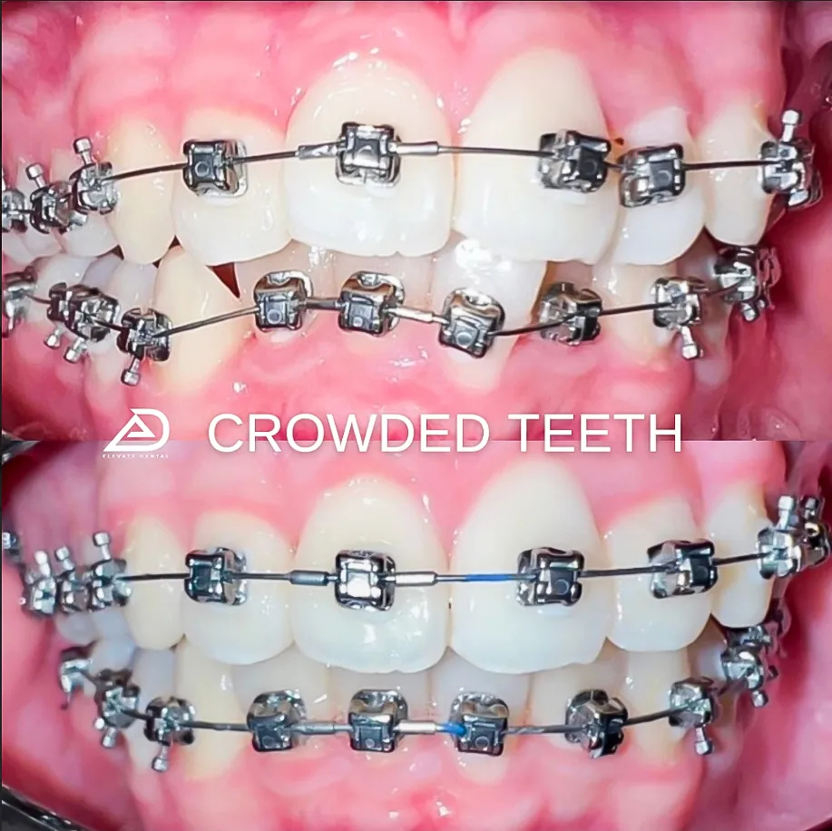 Crowded